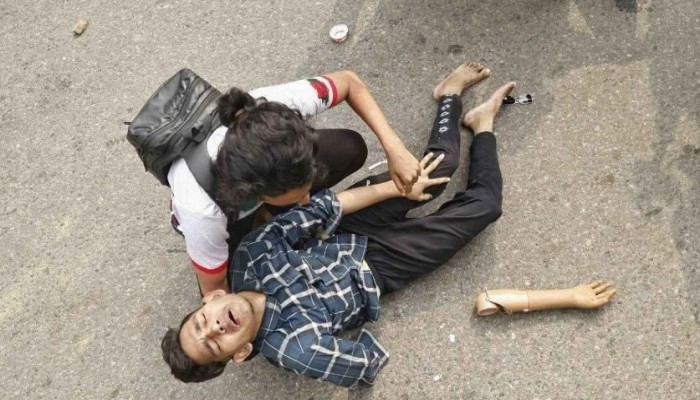 পুলিশের লাঠিচার্জের আঘাতে কৃত্রিম হাত ভেঙে গেল জুলাইযোদ্ধার, আর্তনাদ!